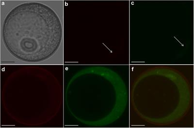 Bcl-2△21 and Ac-DEVD-CHO Inhibit Death of Wheat Microspores